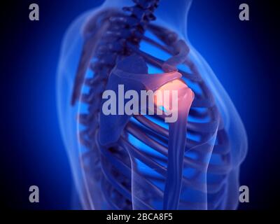 Articulation douloureuse de l'épaule, illustration. Banque D'Images