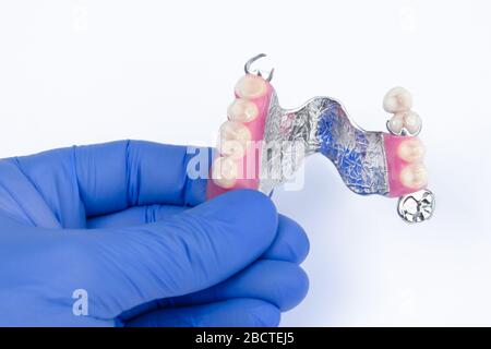 prothèses dentaires. dentisterie orthopédique. prothèses dentaires amovibles. prothèse supérieure à fermoir avec support de couronnes en céramique-métal. prothèse dentaire Banque D'Images