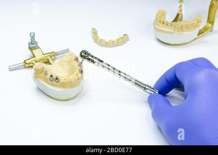 le dentiste dévisse l'implant à l'aide d'une clé. prothèses d'implant. production de couronnes sur implants. implantation dentaire Banque D'Images