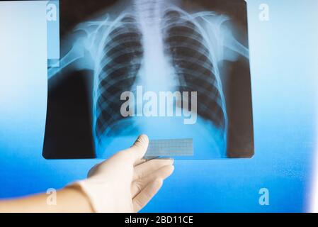 Le médecin examine une photographie radiologique dans un hôpital. Radiographie médicale du thorax Banque D'Images