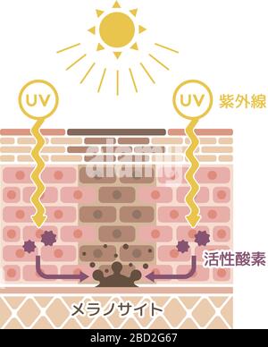 mécanisme de pigmentation de la peau / illustration de tache de peau Illustration de Vecteur