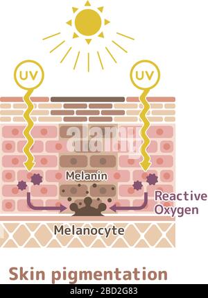 mécanisme de pigmentation de la peau / illustration de tache de peau Illustration de Vecteur