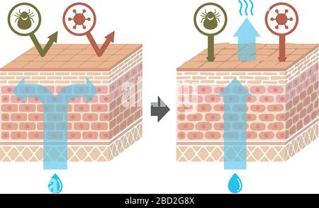 Vue en coupe de l'illustration skin.Comparison de l'effet de protection entre la peau saine et la peau blessée Illustration de Vecteur