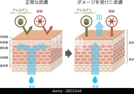 Vue en coupe de l'illustration skin.Comparison de l'effet de protection entre la peau saine et la peau blessée Illustration de Vecteur