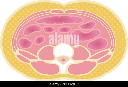 Type d'illustration de l'obésité . Vue en coupe abdominale (graisse sous-cutanée). Illustration de Vecteur