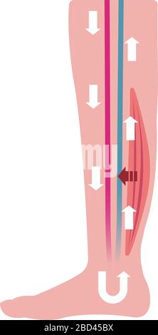 Cause de gonflement (œdème) des jambes. Illustration plate de la jambe normale Illustration de Vecteur