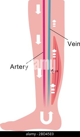 Cause de gonflement (œdème) des jambes. Diminution du débit sanguin due à la faiblesse musculaire. Illustration plate. Illustration de Vecteur