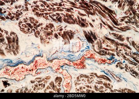 Tissu cardiaque adipeux sous le microscope 200 x. Banque D'Images