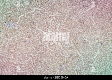 Tissu d'hémosidérose sous le microscope 100 fois Banque D'Images