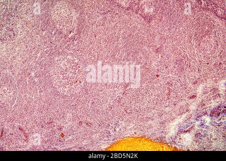 Amygdales aux amandes en coupe transversale sous le microscope 100× Banque D'Images