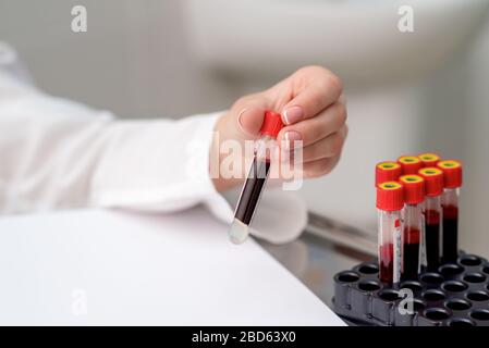 Le médecin prend le tube d'échantillon de sang du plateau de la table. Banque D'Images
