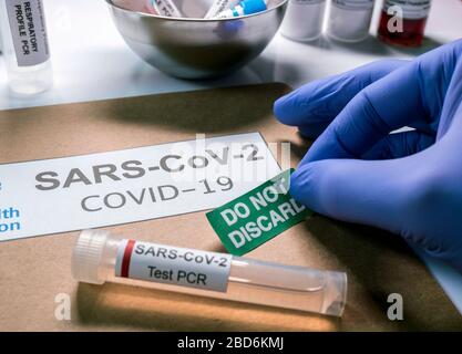 Flacon pcr pour coronavirus SarsCov 2 avec dossier indiquant de ne pas être jeté, image conceptuelle Banque D'Images