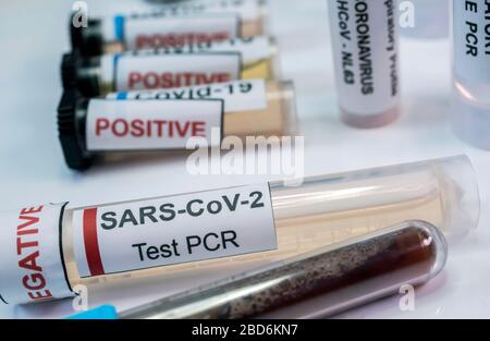 Flacon pcr de SarsCov2 coronavirus, image conceptuelle Banque D'Images