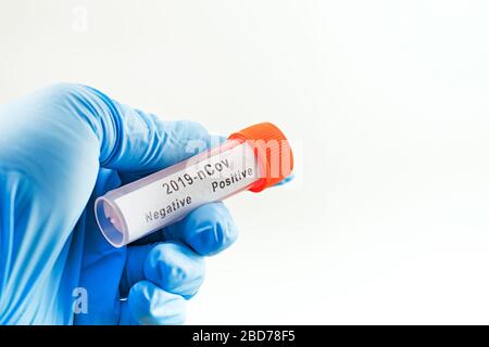 Photographie conceptuelle – tests de coronavirus : une main contient un tube à essai contenant l’échantillon d’un patient Banque D'Images