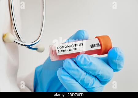 Photographie conceptuelle – tests de coronavirus : une main contient un tube à essai contenant l’échantillon d’un patient Banque D'Images