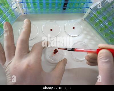 Photo d'une pipette dans les mains d'un chercheur qui goutte une sampe de sang dans un sische de Petri. Création de vaccins. Vue des yeux d'un chercheur. Banque D'Images