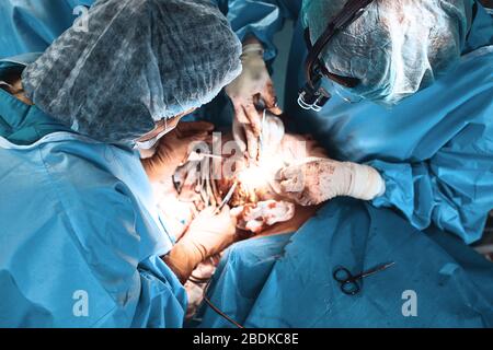Une équipe de chirurgiens se bat pour la vie, une opération réelle, des émotions réelles. L'équipe de soins intensifs se bat pour la vie du patient. Sauver des vies Banque D'Images