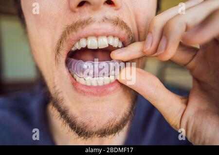 Placer une plaque de mordre l'homme dans sa bouche pour protéger ses dents la nuit du broyage causé par le bruxisme, vue en gros plan de sa main et l'appareil Banque D'Images
