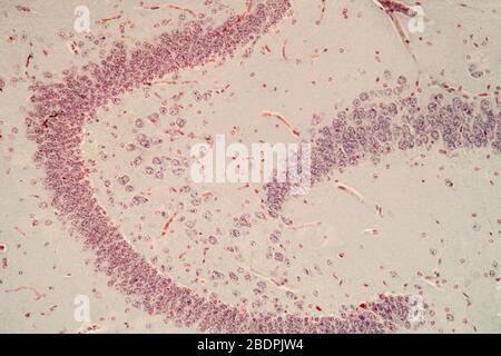 Tissu de cellules cérébrales sous le microscope 100 fois Banque D'Images