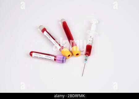 Tubes de sang de coronavirus et seringue de sang remplie sur fond blanc Banque D'Images
