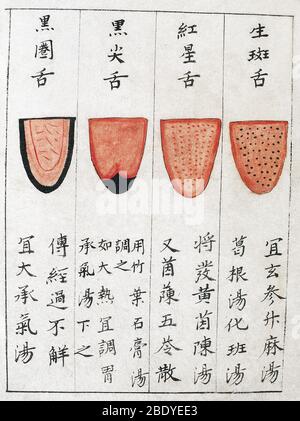 Tableau de diagnostic de la langue chinoise, 1341 Banque D'Images