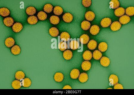 Transmission couleur améliorée micrographe électronique (TEM) de Rotavirus. Le rotavirus du groupe A est endémique dans le monde entier. C'est la principale cause de diarrhée grave chez les nourrissons et les enfants et représente environ la moitié des cas nécessitant une hospitalisation. Le rotavirus est généralement une maladie facile à gérer de l'enfance, mais en 2013, le rotavirus a causé 37% des décès d'enfants par la diarrhée et 215 000 décès dans le monde, et près de 2 millions de plus sont gravement malades. La plupart de ces décès ont été enregistrés dans les pays en développement. Aux États-Unis, avant le lancement du programme de vaccination contre le rotavirus, le rotavirus CA Banque D'Images