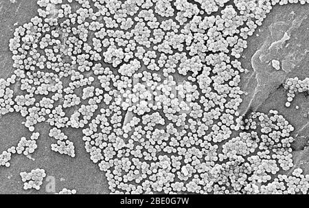 De nombreux amas de bactéries Staphylococcus aureus résistantes à la méthicilline, communément appelés SARM. Des éclosions ou des grappes de SARM récemment reconnues dans les milieux communautaires ont été associées à des souches qui ont des propriétés microbiologiques et génétiques uniques comparativement aux souches de SARM traditionnelles hospitalières. Cela suggère que certaines propriétés biologiques, par exemple des facteurs de virulence comme les toxines, peuvent permettre aux souches communautaires de se propager plus facilement ou de causer plus de maladies de la peau. Une souche commune appelée USA300-0114 a causé de nombreuses éclosions de ce type aux États-Unis. Staphylococcus Banque D'Images