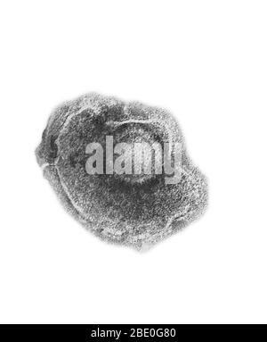 Transmission micrographe électronique (TEM) d'un virus de zoster de Varicella. Le virus du zoster varicelle ou le virus varicelle-zoster (VZV) est l'un des huit herpesvirus connus pour infecter les humains et les vertébrés. Le VZV ne touche que les humains et provoque généralement la varicelle chez les enfants, les adolescents et les jeunes adultes et le zona chez les adultes et rarement chez les enfants. VZV est connu sous de nombreux noms, notamment le virus de la varicelle, le virus de la varicelle, le virus de la zoster et le virus de l'herpèsvirus humain de type 3 (HHV-3). VZV multiplie les poumons et provoque une grande variété de symptômes. Après l'infection primaire (varicelle), le virus va le faire Banque D'Images