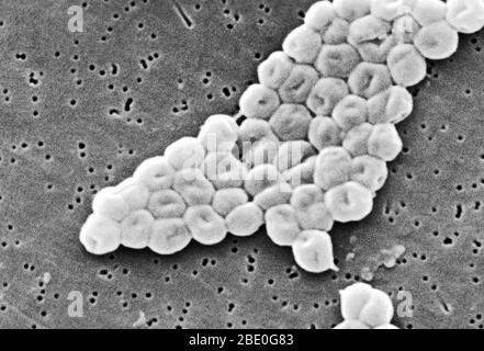 SEM représente un groupe fortement amplifié de bactéries Gram-négatives, non motiles Acinetobacter baumannii; Mag - 13331x. Les membres du genre Acinetobacter sont des tiges non motiles, de 1 à 1,5 µm de diamètre et de 1,5 à 2,5 µm de longueur, qui deviennent sphériques en forme pendant leur phase stationnaire de croissance. Acinetobacter baumannii est une espèce de bactéries pathogènes, appelée bactérie aérobie Gram-négative, résistante à la plupart des antibiotiques. En raison de sa résistance au traitement des médicaments, certaines estimations indiquent que la maladie tue chaque année des dizaines de milliers de patients hospitaliers américains. La maladie c Banque D'Images