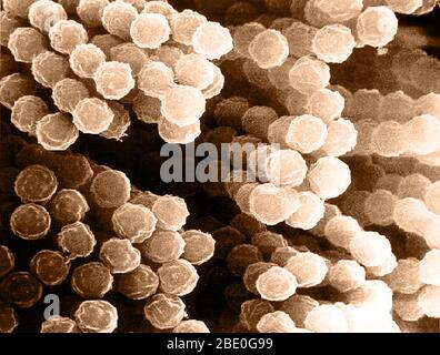 Micrographe électronique à balayage amélioré en couleur (SEM) des espèces Aspergillus. Plus de 185 espèces de champignons sont incluses dans le genre Aspergillus, le plus commun étant fumigatus. Aspergillus est un groupe de moisissures connues pour produire des aflatoxines (un cancérogène connu) qui peuvent infecter les cultures fourragères et les aliments. Les champignons peuvent également causer des maladies allergiques, des infections et des maladies connues sous le nom d'Aspergillose. Banque D'Images