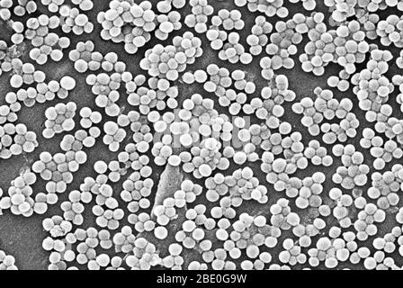 De nombreux amas de bactéries Staphylococcus aureus résistantes à la méthicilline, communément appelés SARM. Des éclosions ou des grappes de SARM récemment reconnues dans les milieux communautaires ont été associées à des souches qui ont des propriétés microbiologiques et génétiques uniques comparativement aux souches de SARM traditionnelles hospitalières. Cela suggère que certaines propriétés biologiques, par exemple des facteurs de virulence comme les toxines, peuvent permettre aux souches communautaires de se propager plus facilement ou de causer plus de maladies de la peau. Une souche commune appelée USA300-0114 a causé de nombreuses éclosions de ce type aux États-Unis. Staphylococcus Banque D'Images