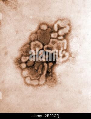 Micrographe électronique à transmission colorisée (TEM) du virus A/New Jersey/76 (HSW 1), alors que dans le premier passage du virus à travers un oeuf de poulet. La grippe porcine (grippe porcine) est une maladie respiratoire des porcs causée par la grippe de type A qui provoque régulièrement des éclosions de grippe chez les porcs. Les virus de la grippe porcine causent des taux élevés de maladie et de mortalité chez les porcs. Les virus de la grippe porcine peuvent circuler chez les porcs tout au long de l'année, mais la plupart des éclosions chez les troupeaux de porcs se produisent à la fin de l'automne et en hiver, comme chez les humains. Le virus de la grippe porcine classique (type de grippe Banque D'Images