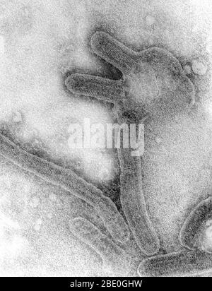 Ce micrographe négatif d'électrons de transmission tachés (TEM) représente un certain nombre de virions du virus de Marburg, qui avaient été cultivés dans un environnement de cellules de culture tissulaire. La fièvre hémorragique de Marburg est un type rare et grave de fièvre hémorragique qui affecte à la fois les primates humains et non humains. Causée par un virus d'ARN zoonotique génétiquement unique (d'origine animale) de la famille des filovirus, sa reconnaissance a conduit à la création de cette famille de virus. Les quatre espèces de virus Ebola sont les seuls autres membres connus de la famille des filovirus. Après une période d'incubation de 5 à 10 jours, l'apparition de la maladie Banque D'Images