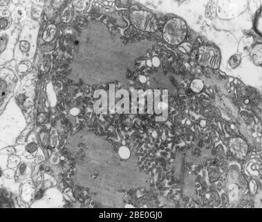 Le micrographe électronique de transmission montre plusieurs virus de rage, foncés et en forme de puce, dans un échantillon de tissu infecté. La rage est une maladie virale évitable des mammifères qui se transmet le plus souvent par la morsure d'un animal rabide. La grande majorité des cas de rage signalés aux centres de lutte et de prévention des maladies (CDC) chaque année se produisent chez des animaux sauvages comme les ratons laveurs, les mouffettes, les chauves-souris et les renards. Les animaux domestiques représentent moins de 10 % des cas de rage signalés, les chats, les bovins et les chiens ayant le plus souvent signalé des rabides. Banque D'Images