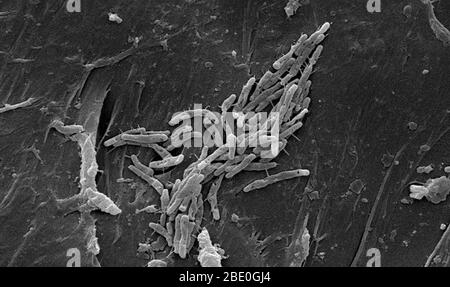 Micrographe électronique à balayage SEM) d'un certain nombre de bacilles Gram-positif, ou de bactéries Mycobacterium fortuituum en forme de tige. M. fortuitutum est classé comme une Mycobacterium en croissance rapide, en raison du fait qu'il peut être cultivé sur un milieu de culture de laboratoire en moins de 7 jours. En tant que pathogène humain, cet organisme a été déterminé comme la cause des infections de la peau, y compris la furonculose, c'est-à-dire les bronles, sur les jambes des personnes recevant des pédicures dans les salons de l'ongle. En tant que bactérie non tuberculeuse (NTB), M. fortuitutum est membre du même genre que son cousin Mycobacterium tuberculosis, mais il est cl Banque D'Images