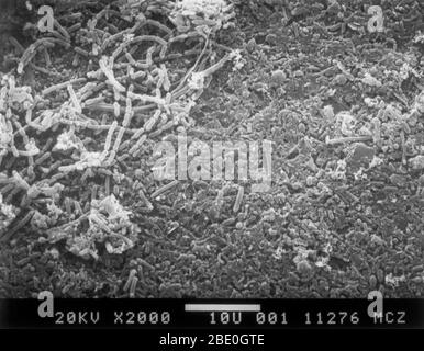 Balayage du micrographe électronique (SEM) des eaux usées brutes filtrées sur une membrane de nucléophore. Notez la bactérie filamenteuse et les diverses bactéries en forme de tige. Agrandissement 2 000 x à une taille d'image de 35 mm. Banque D'Images