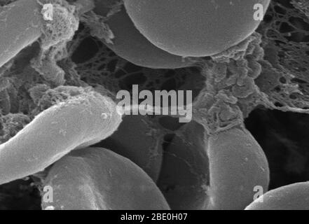 Ce micrographe d'électrons à balayage (SEM) très agrandi a montré un examen plus étroit des détails exposés par le nombre de globules rouges trouvés enmaillés dans une matrice fibreuse sur la surface luminale d'un système vasculaire à indwelling; agrandi 11397x. Dans ce cas, le cathéter d'endwelling était un tube qui était laissé en place créant un portail de brevet directement dans un vaisseau sanguin. Notez la forme cytomorphologique biconvexe de chaque érythrocyte, qui augmente la surface de ces cellules remplies d'hémoglobine, favorisant ainsi un plus grand degré d'échange de gaz, qui est leur fonction principale in vivo Banque D'Images