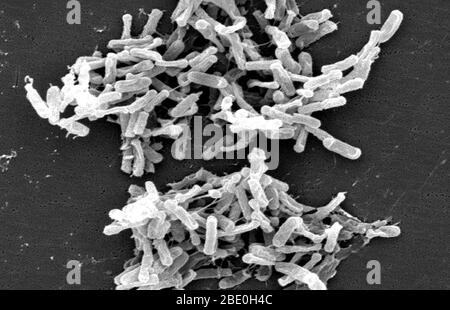 Micrographe électronique à balayage (SEM) montrant une bactérie à Clostridium difficile Gram-positive. Ces organismes C. difficile ont été cultivés à partir d'un échantillon de selles obtenu lors d'une éclosion de maladie gastro-intestinale et extraits à l'aide d'un filtre de 0,1 µm. C. difficile cause la diarrhée et des troubles intestinaux plus graves comme la colite. Banque D'Images