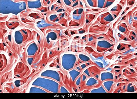 Le micrographe électronique à balayage (SEM) représente un regroupement de nombreuses bactéries Gram-négatives, anaérobies, Borrelia burgdorferi, qui avaient été dérivées d'une culture pure. Cet organisme pathogène est responsable de la maladie la maladie de Lyme, une maladie zoonotique, transmise aux humains par voie de piqûre de tique. B. burgdorferi appartient à un groupe de bactéries appelées spirochètes, dont l'apparence ressemble à un ressort spiralé. B. burgdorferi bactéries peut infecter plusieurs parties du corps, produisant différents symptômes à différents moments. Tous les patients atteints de la maladie de Lyme n'auront pas tous symptaux Banque D'Images