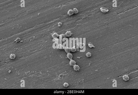 Les amibes libres (FLA) du groupe Amoebozoa sont des causes importantes de maladies chez les humains et les animaux. Couleur améliorée SEM d'un biofilm d'eau potable (potable) cultivé en laboratoire, avec la présence de kystes de Vermamoeba vermiformis (Hartmanella). Les bactéries aquatiques ont été cultivées comme biofilm sur l'acier pendant une semaine. V. vermiformis a ensuite été ajouté, et phagocytisé la bactérie qui s'est multipliée dans les vésicules qui sont devenues des kystes dans lesquels la bactérie vivra jusqu'à ce qu'elle se rupture. Vermamoeba vermiformis est une amibe libre-vivant (FLA), est de nature répandue et a été isolée du sol, de l'eau douce, de l'air, et un Banque D'Images