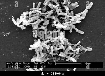 Micrographe électronique à balayage (SEM) montrant une bactérie à Clostridium difficile Gram-positive. Ces organismes C. difficile ont été cultivés à partir d'un échantillon de selles obtenu lors d'une éclosion de maladie gastro-intestinale et extraits à l'aide d'un filtre de 0,1 µm. C. difficile cause la diarrhée et des troubles intestinaux plus graves comme la colite. Banque D'Images