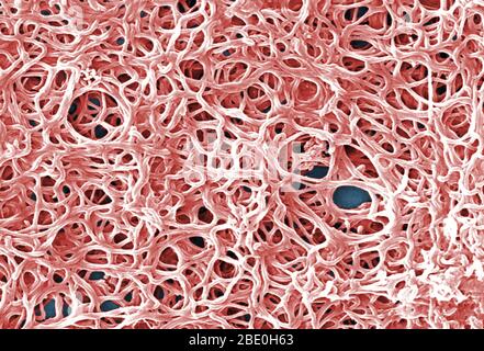 Le micrographe électronique à balayage (SEM) représente un regroupement de nombreuses bactéries Gram-négatives, anaérobies, Borrelia burgdorferi, qui avaient été dérivées d'une culture pure. Cet organisme pathogène est responsable de la maladie la maladie de Lyme, une maladie zoonotique, transmise aux humains par voie de piqûre de tique. B. burgdorferi appartient à un groupe de bactéries appelées spirochètes, dont l'apparence ressemble à un ressort spiralé. B. burgdorferi bactéries peut infecter plusieurs parties du corps, produisant différents symptômes à différents moments. Tous les patients atteints de la maladie de Lyme n'auront pas tous symptaux Banque D'Images