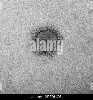 Micrographe électronique à transmission par coloration négative (TEM) montrant une particule de MERS-CoV avec des projections de surface en forme de club entourant la périphérie de la particule, caractéristique des coronavirus. Le coronavirus du syndrome respiratoire du Moyen-Orient (MERS-CoV) est un nouveau coronavirus (nCoV) signalé pour la première fois le 24 septembre 2012 par le virologue égyptien Ali Mohamed Zaki à Djeddah, en Arabie Saoudite. Il a isolé et identifié un coronavirus précédemment inconnu des poumons d'un patient mâle de 60 ans souffrant d'une pneumonie aiguë et d'une insuffisance rénale aiguë. MERS-CoV est le sixième nouveau type de coronaviru Banque D'Images