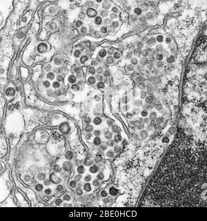 Micrographe électronique de transmission (TEM) d'une section mince du MERS-CoV, montrant les particules sphériques et les sections transversales à travers le nucléocapsid viral. Le coronavirus du syndrome respiratoire du Moyen-Orient (MERS-CoV) est un nouveau coronavirus (nCoV) signalé pour la première fois le 24 septembre 2012 par le virologue égyptien Ali Mohamed Zaki à Djeddah, en Arabie Saoudite. Il a isolé et identifié un coronavirus précédemment inconnu des poumons d'un patient mâle de 60 ans souffrant d'une pneumonie aiguë et d'une insuffisance rénale aiguë. Le MERS-COV est le sixième nouveau type de coronavirus comme le SRAS (mais il est encore distinct de celui-ci et du commun-c) Banque D'Images