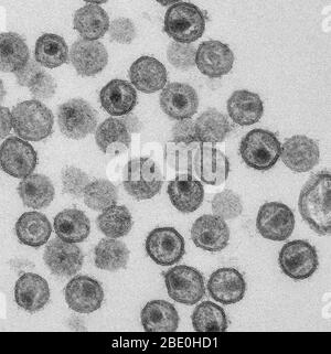 Micrographe d'électrons de transmission (TEM) montrant des particules de SIV (virus de l'immunodéficience Simian) matures. Agrandissement inconnu. Banque D'Images