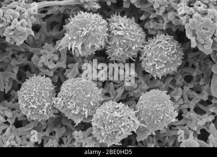 Balayage du micrographe électronique (SEM) montrant les lymphocytes (globules blancs). Un lymphocyte est l'un des sous-types de globules blancs du système immunitaire des vertébrés. Les lymphocytes comprennent les cellules tueuses naturelles (cellules NK) (qui fonctionnent dans l'immunité cytotoxique innée médiée par les cellules), les cellules T (pour l'immunité adaptative médiée par les cellules, cytotoxique) et les cellules B (pour l'immunité adaptative humorale, basée sur les anticorps). Ils sont le type principal de cellule trouvé dans la lymphe, qui a provoqué le nom de lymphocyte. Agrandissement inconnu. Banque D'Images