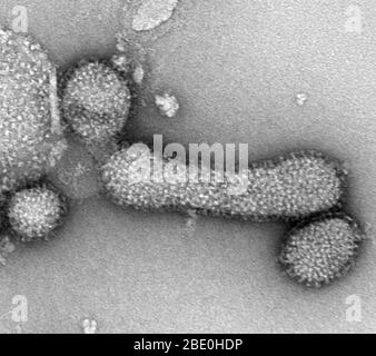 Micrographe électronique de transmission de taches négatives (TEM) du virus de la grippe A (H1N 1), souche PR8. Agrandissement inconnu. Banque D'Images