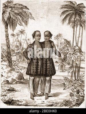 Chang et Eng Bunker (11 mai 1811 - 17 janvier 1874) étaient les frères jumeaux conjoints dont la condition et le lieu de naissance sont devenus la base du terme 'jumeaux siamois'. En 1829, ils ont été découverts par le marchand britannique Robert Hunter et exposés comme une curiosité pendant une tournée mondiale. À la résiliation de leur contrat, ils sont devenus naturalisés citoyens des États-Unis, installés sur une plantation, ont acheté des esclaves et adopté le nom de Bunker' les jumeaux sont morts le même jour en janvier 1874. Chang, qui avait contracté la pneumonie, est mort subitement dans son sommeil, mais Eng a refusé d'être séparé de son frère mort Banque D'Images