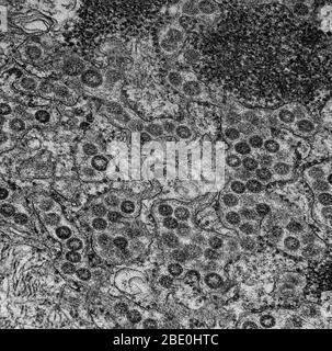 Micrographe électronique de transmission des particules du syndrome respiratoire du Moyen-Orient virusCoV présentes dans la lumière du réticulum endoplasmique dans une cellule MRC-5 infectée. Le coronavirus du syndrome respiratoire du Moyen-Orient (MERS-CoV), également appelé EMC/2012 (HCoV-EMC/2012), est une espèce nouvelle d'ARN monobrin de détection positive du genre Betacoronavirus. D'abord appelé coronavirus nouveau 2012 ou tout simplement nouveau coronavirus, il a été signalé pour la première fois en 2012 après séquençage génomique d'un virus isolé d'échantillons d'expectorations de patients qui sont tombés malades dans une éclosion de grippe de 2012. En juin 2014, les cas MERS-COV h Banque D'Images