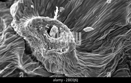 Sous un agrandissement modéré de 225 x, ce micrographe électronique à balayage (SEM) a décrit les caractéristiques morphologiques de surface d'une 'horloge de pissenlit', d'une plante de Dédelion commune, Taraxacum officinale. L'horloge est le 'boule de maliéme' de graines arrangées de façon à être facilement dispersées par le vent, ou la largeur d'un enfant curieux. Dans ce champ de vision, les restes d'un attachement de graine sont visibles comme une petite nuance qui dépasse d'un petit papule. C'est à partir de ces points de type nub que les graines équipées de "parachute" se détachent, et sont soufflées, parfois sur une distance de miles. Banque D'Images